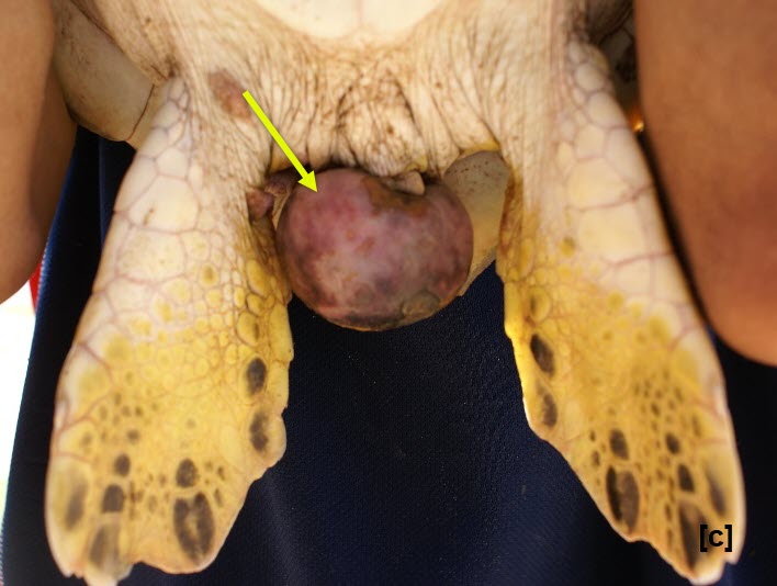 tumors